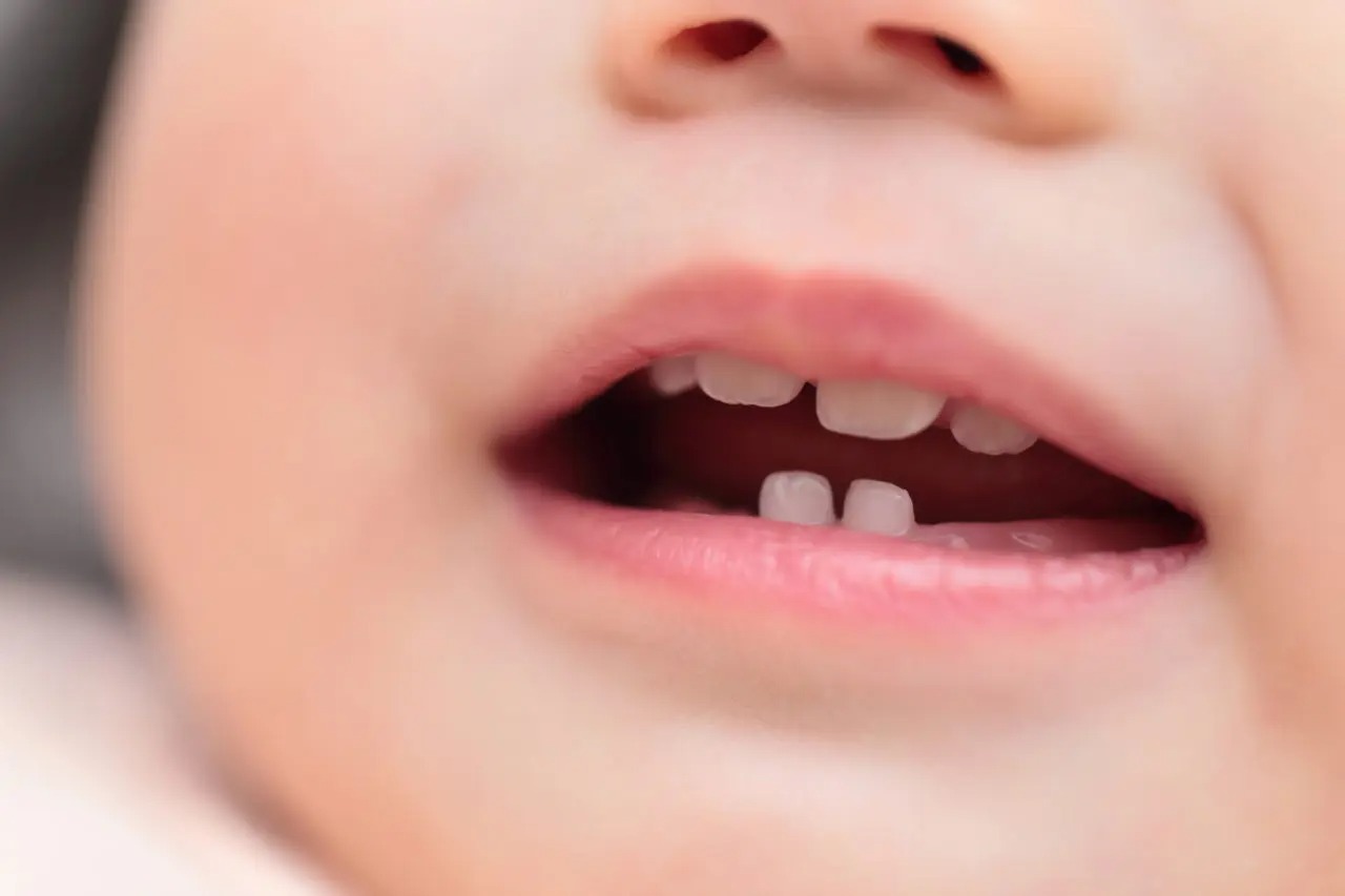 子供が転んで前歯を打った！